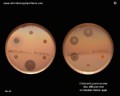 klebsiella pneumoniae antibiotic resistant, ESBL positive